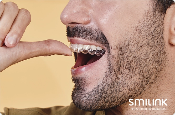 quem tem dentes do siso pode usar aparelho invisível